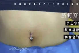 脐钉穿刺（非教学视频）视频封面