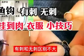 被有倒刺鱼钩挂到肉，衣服上处理小技巧，有刺无刺鱼钩使用误区视频封面