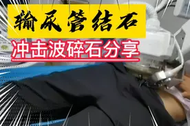输尿管结石，B超定位，冲击波碎石全过程分享视频封面