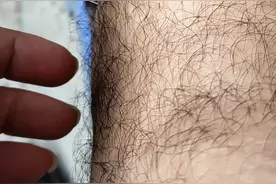 玩玩行针手法视频封面