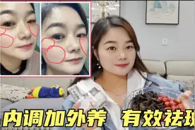 33岁主妇坚持多年内调和外养 调节内分泌还能快速有效祛斑视频封面