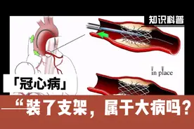 冠心病，装了支架，属于严重疾病吗？视频封面