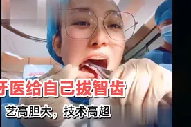 牙医是如何给自己拔智齿的，百闻不如一见，涨知识了视频封面
