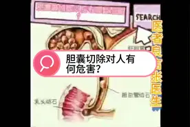 切除胆囊对身体有何危害？医生坦言：可能超出你的想象！视频封面