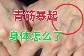 很多人手上“青筋暴起”，3种情况青筋多，到底说明身体怎么了？视频封面