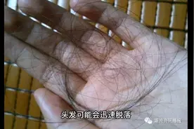 可能导致脱发的原因。女性分娩后脱发😳😳😳😳视频封面