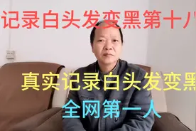 记录白头发变黑了第十八天，记真实记录白头发变黑的全网第一人。视频封面