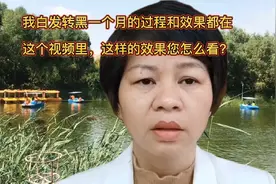 80后宝妈体验白发转黑养发一个月，这样的效果你们觉得怎么样视频封面