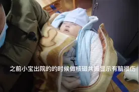 34周的早产宝宝核磁共振有脑损伤在做康复治疗和高压氧治疗视频封面