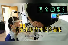 七岁女孩一觉醒来眼睛肿成熊猫眼，到底怎么了？妈妈赶紧带去医院视频封面