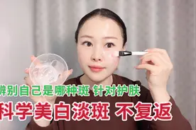 面部常见的色素斑，看看你属于哪一种？针对肤质淡斑效果好