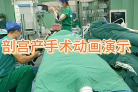 剖宫产动画演示，母爱伟大！视频封面
