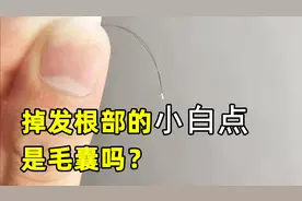 掉发根部的小白点是毛囊吗？视频封面