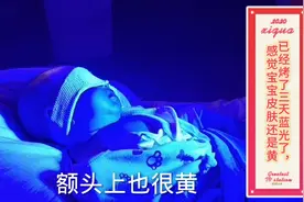 每天一有时间就给宝宝烤蓝光，烤了三天感觉宝宝皮肤还是很黄呢。视频封面