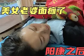 新冠阳康之后，美女老婆竟然面瘫了，扎了满脸针看着就心疼视频封面