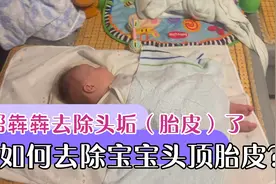 犇犇的奶奶帮犇犇去除头顶胎皮，这个操作宝爸不敢来视频封面