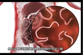 我们身体里的蛔虫怎么来的？视频封面
