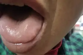 舌苔集锦图，一舌而知健康指数。视频封面