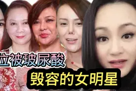 12位被玻尿酸毁掉的女明星，王心凌像老太婆，张檬关之琳无戏可拍视频封面