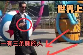 世界上唯一有三条腿的人视频封面