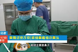 【鼻骨过宽改窄|收缩鼻槛缩小鼻头-术前分析】视频封面