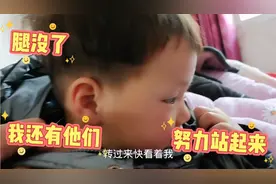 大橙子腿虽然没了，但是我有他们，我想开了，除了腿，我啥都有！视频封面