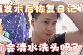 植发术后一年零两个半月，现在头发又粗又黑？清水洗头能坚持多久视频封面