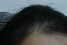 我的头发视频封面