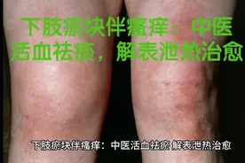 下肢瘀块伴瘙痒：中医活血祛瘀，解表泄热治愈视频封面