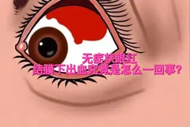 无症状眼红-结膜下出血究竟是怎么回事？视频封面