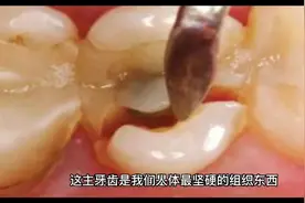 牙齿劈裂了怎么办？视频封面