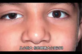 从小到大，你的眼睛大小变过吗视频封面