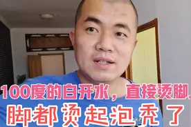 干活不小心100度的白开水，直接烫脚上，脚烫起泡，脱了皮，疼死视频封面