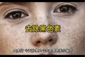 六个去除黑色素小偏方，