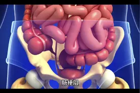 肠梗阻视频封面