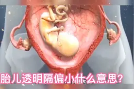 胎儿透明隔偏小怎么办？视频封面