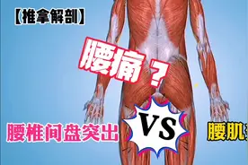正确认识腰痛，腰椎间盘突出和腰肌劳损如何区分？视频封面