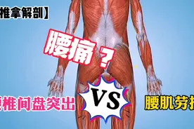 正确认识腰痛，腰椎间盘突出和腰肌劳损如何区分？视频封面