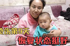 14个月儿子烫伤第9天，看到现在的恢复状态，清清稍微松了口气视频封面