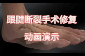 跟腱断裂手术修复动画演示，大家觉得能长好吗？视频封面