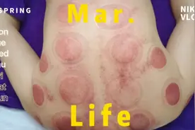 女士精油开背刮痧拔罐视频封面