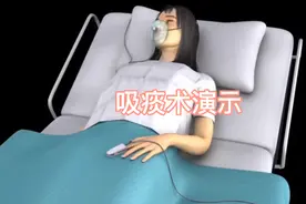 吸痰术演示，前方高能！视频封面