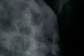 介绍给有需要朋友，真心好用视频封面