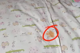 超级实用！去油渍的小妙招，留在衣服上很久的油渍也没问题奥！视频封面