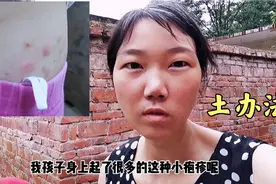 孩子身上起痒疙瘩，农村婆婆寻来一花一草煎水擦一擦，值得收藏视频封面