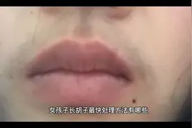 女孩子长胡子最快的处理方法有哪些？视频封面