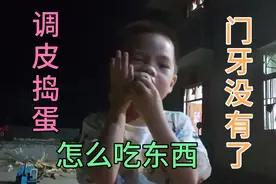 农村3岁儿童把门牙摔断了，不敢用门牙吃东西，不知道还能不能长视频封面
