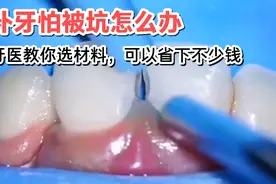 补牙怕被坑怎么办？看看牙医如何教你选材料，让你省下不少钱视频封面