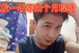这是我植发一年多来发现的最大副作用，脱发要趁早治疗视频封面