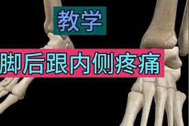 教你崴脚脖子，脚后跟内侧疼痛的治疗方法！视频封面
